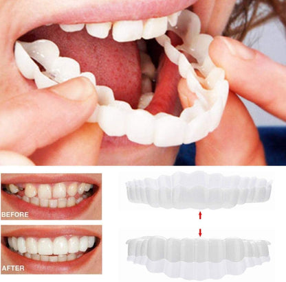 Snap-On Smile Veneer Teeth Cover Set