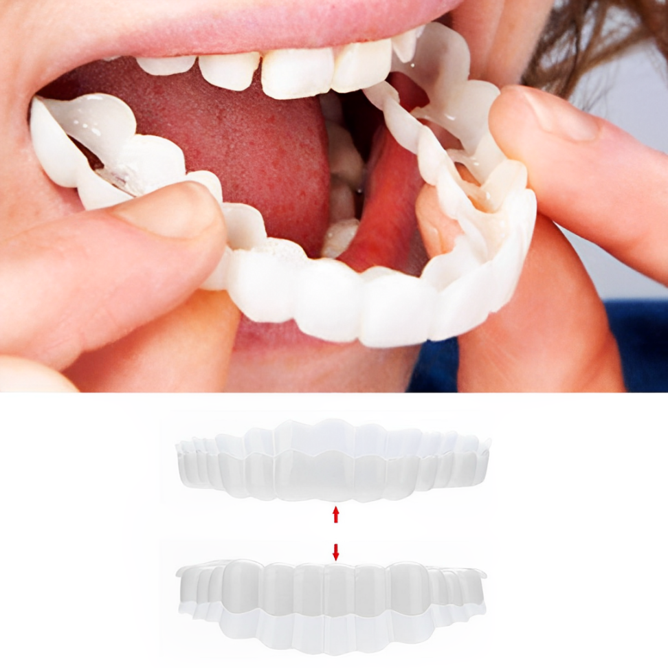 Snap-On Smile Veneer Teeth Cover Set
