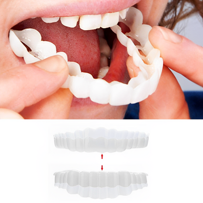 Snap-On Smile Veneer Teeth Cover Set